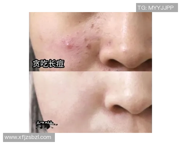 篮球明星也有烦恼他们的痘痘困扰与青春期的真实写照